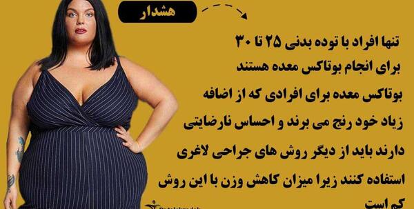 عکس قبل و بعد بوتاکس معده