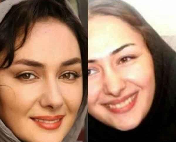 عکس قبل از جراحی بینی