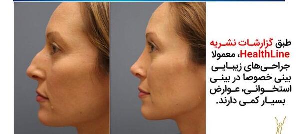 عکس قبل و بعد جراحی بینی