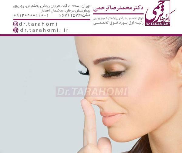 عکس برداری قبل جراحی بینی