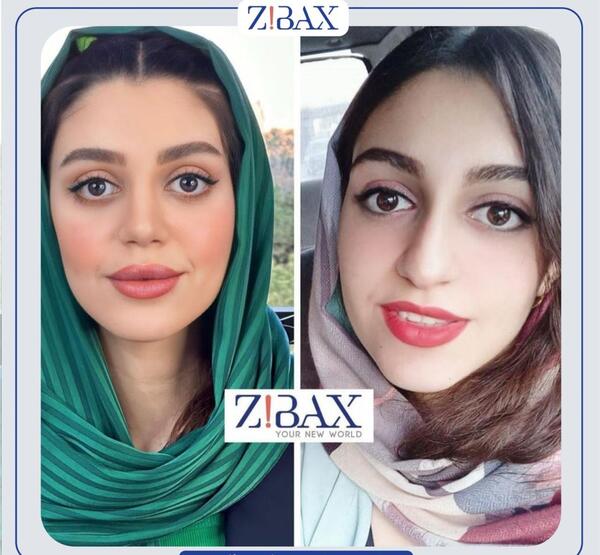 عکس برداری قبل جراحی بینی