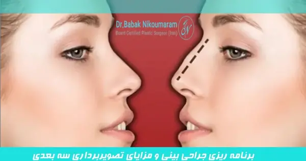 گرفتن عکس قبل از جراحی بینی