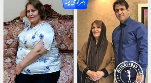 عکس قبل و بعد چاقی و لاغری