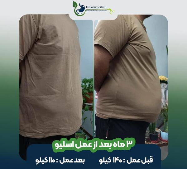 عکس قبل و بعد چاقی و لاغری