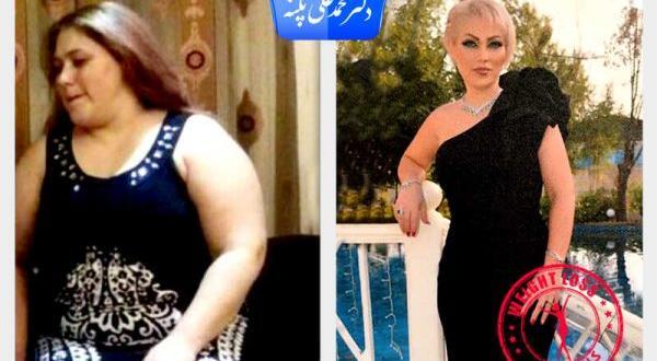 عکس قبل و بعد چاقی و لاغری