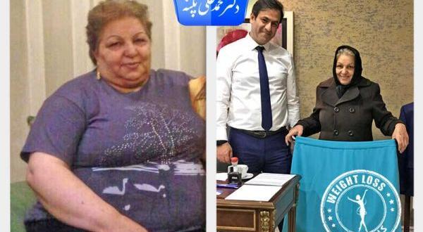 عکس قبل و بعد چاقی و لاغری