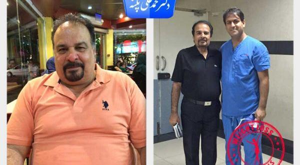 عکس قبل و بعد چاقی و لاغری