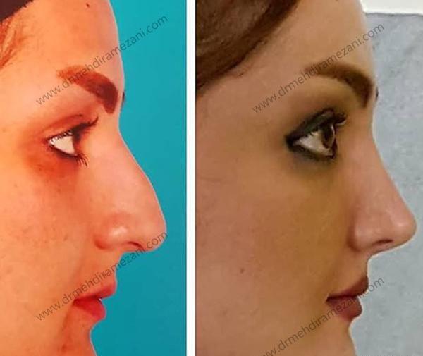 عکس دماغ های عملی قبل و بعد عمل