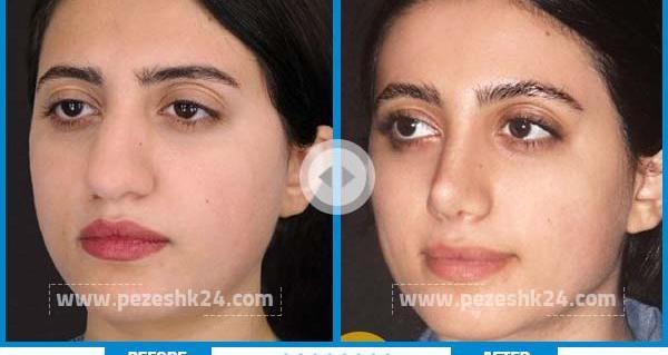 عکس دماغ های عملی قبل و بعد عمل