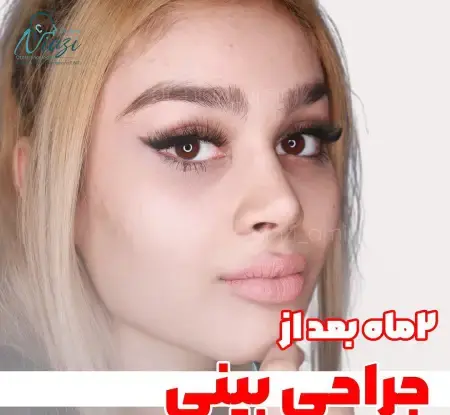 عکس دماغ های عملی قبل و بعد عمل