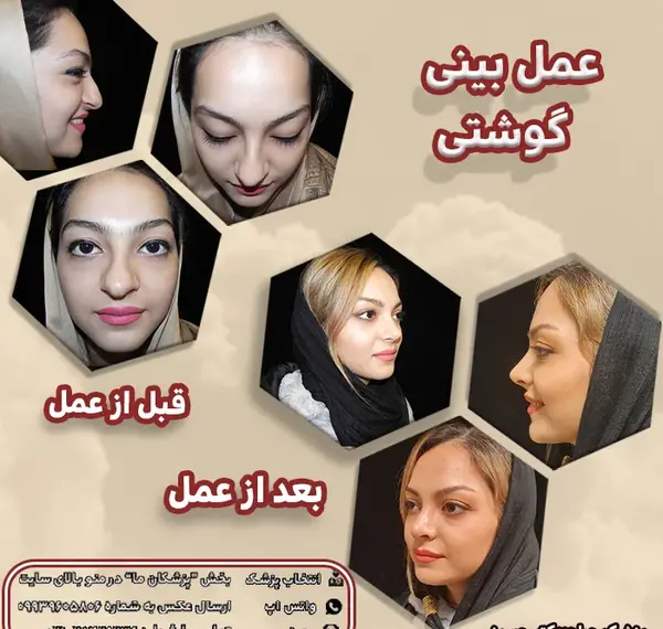 عکس دماغ های عملی قبل و بعد عمل