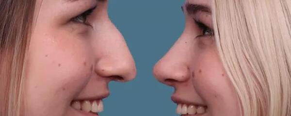عکس دماغ های عملی قبل و بعد عمل