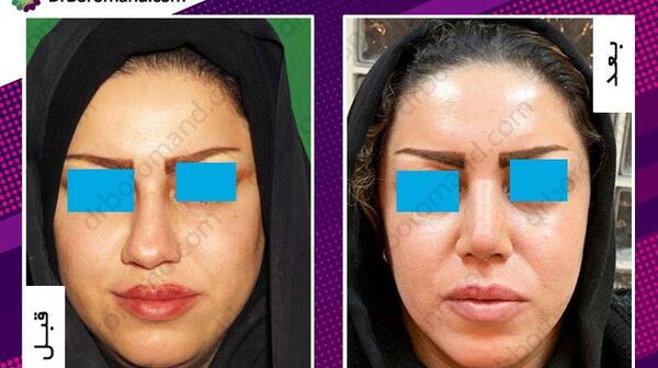 عکس دماغ های عملی قبل و بعد عمل
