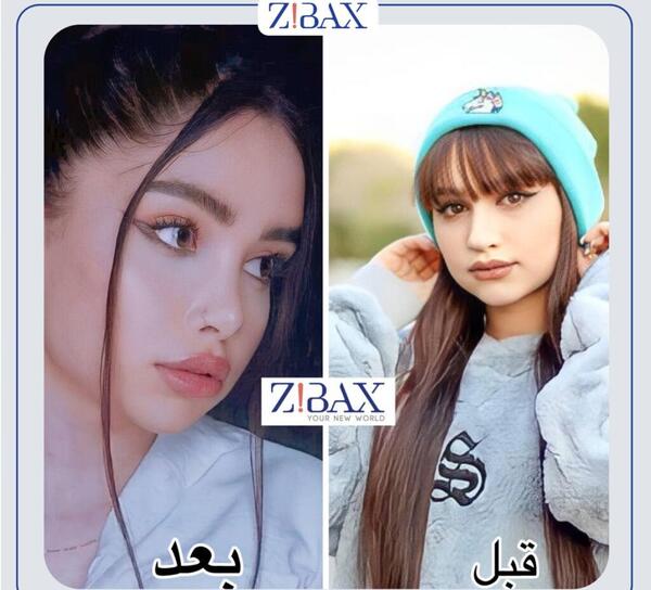 عکس قبل و بعد دماغ عملی