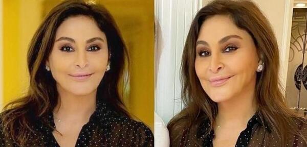 عکس دنیا خواننده قبل از عمل