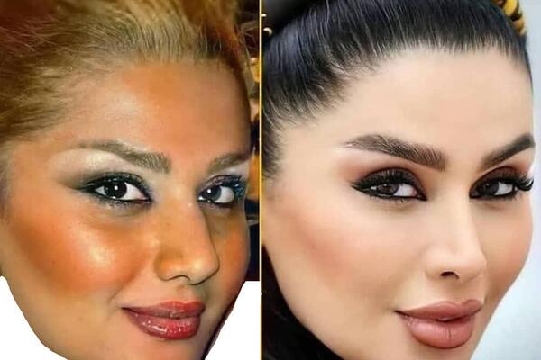 عکس دنیا خواننده قبل از عمل