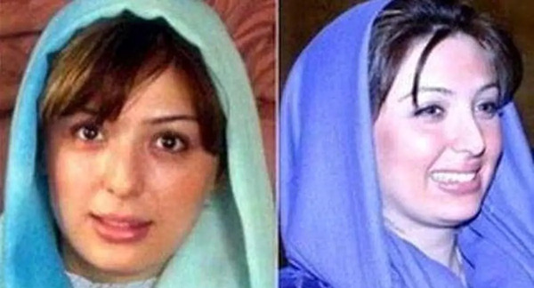 عکس قبل و بعد از عمل نیوشا ضیغمی