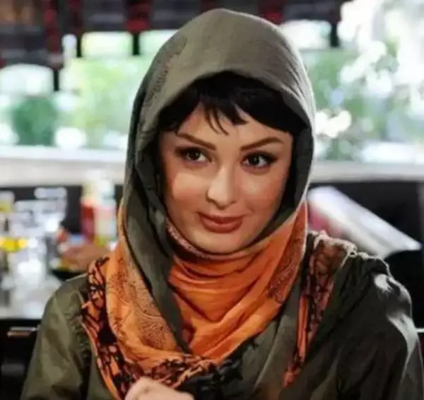 عکس قبل و بعد از عمل نیوشا ضیغمی