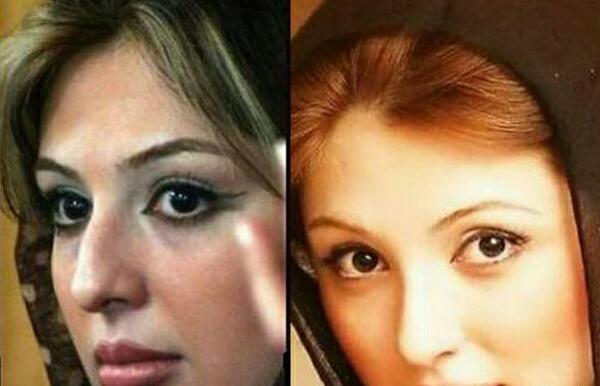 عکس قبل و بعد از عمل نیوشا ضیغمی