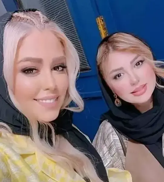 عکس قبل و بعد از عمل نیوشا ضیغمی