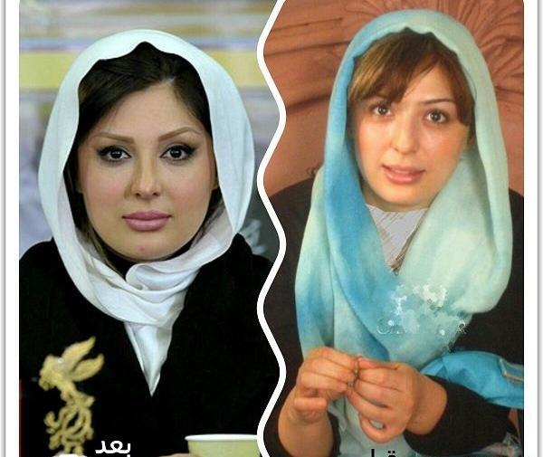 عکس های نیوشا ضیغمی قبل از عمل زیبایی