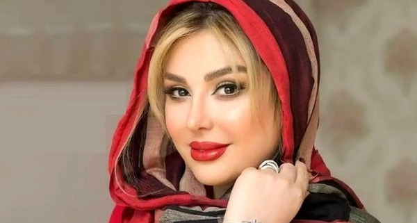 عکس های نیوشا ضیغمی قبل از عمل زیبایی