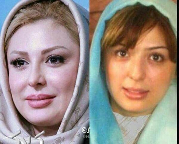 عکس های نیوشا ضیغمی قبل از عمل زیبایی