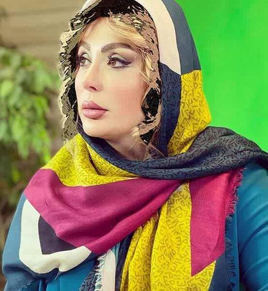 عکس های نیوشا ضیغمی قبل از عمل زیبایی