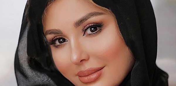 عکس های نیوشا ضیغمی قبل از عمل زیبایی