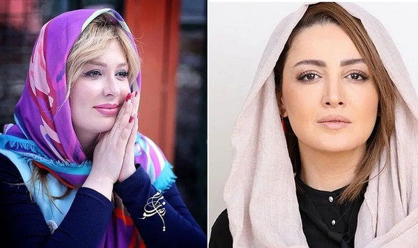 عکس های نیوشا ضیغمی قبل از عمل زیبایی