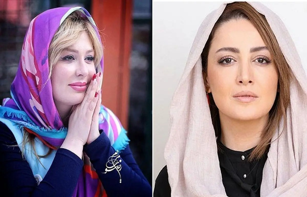 عکس های نیوشا ضیغمی قبل از عمل زیبایی