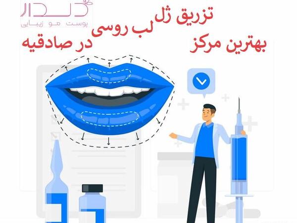 عکس قبل و بعد ژل لب روسی