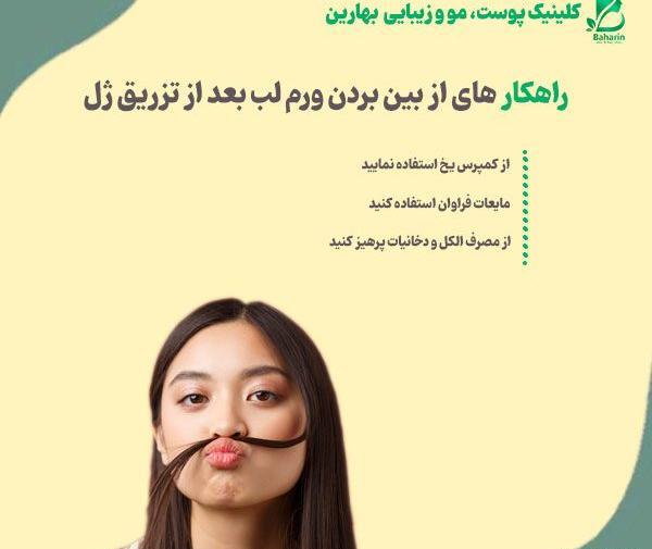 عکس قبل و بعد ورم ژل لب