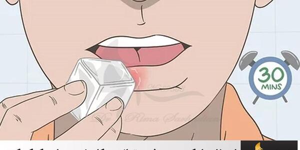 عکس قبل و بعد ورم ژل لب