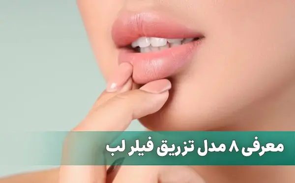 عکس قبل بعد ژل لب