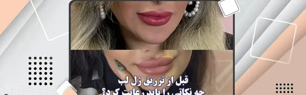 عکس قبل بعد ژل لب