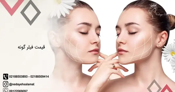 عکس قبل و بعد از تزریق ژل گونه
