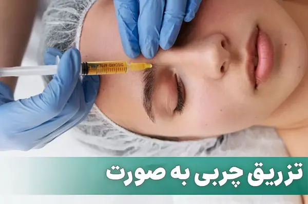 عکس قبل و بعد تزریق ژل به گونه