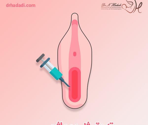 عکس قبل و بعد تزریق ژل به واژن