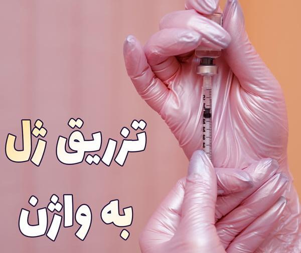 عکس قبل و بعد تزریق ژل به واژن