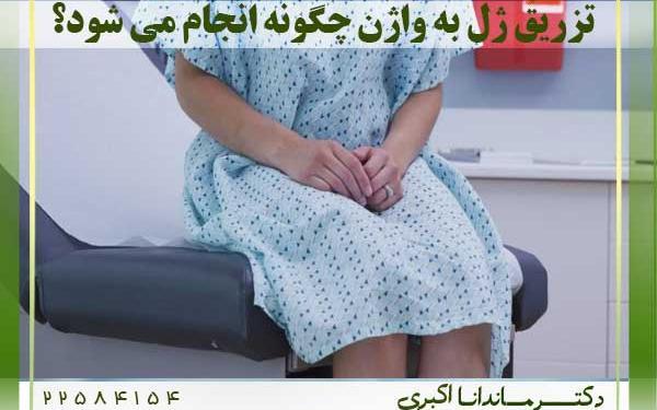 عکس قبل و بعد تزریق ژل به واژن