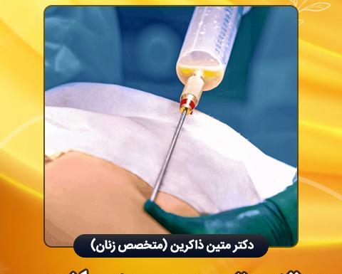 عکس قبل و بعد تزریق ژل به واژن