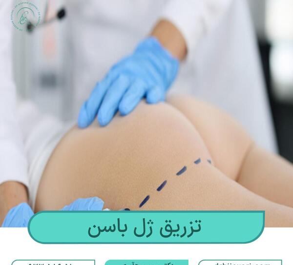 عکس قبل و بعد تزریق ژل به واژن نی نی سایت