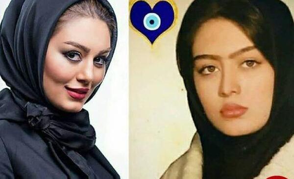 عکس قبل و بعد سحر قریشی