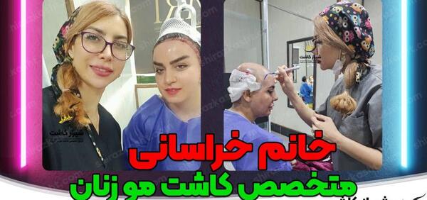 عکس قبل و بعد کاشت مو زنان