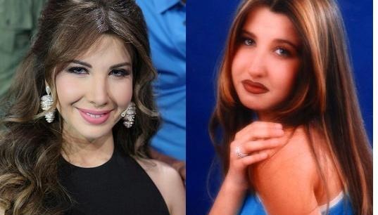 عکس های قبل عمل نانسی عجرم