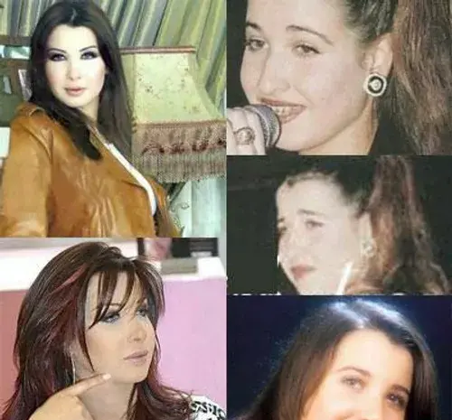 عکس نانسی عجرم قبل از عمل زیبایی