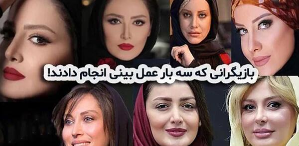 عکس قبل و بعد عمل بینی محسن یگانه