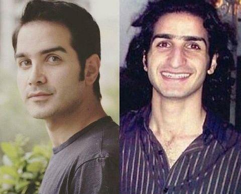 عکس قبل و بعد عمل بینی محسن یگانه
