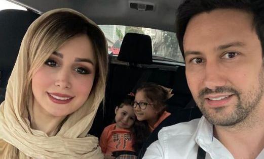 عکس قبل و بعد عمل بینی شاهرخ استخری